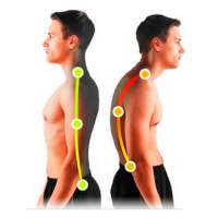 Posture Corrector - Tips to improve your posture on 9Apps