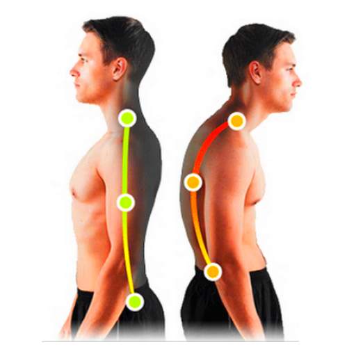 Posture Corrector - Tips to improve your posture