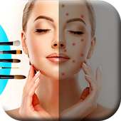 Face Blemish Remover on 9Apps