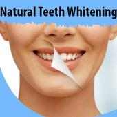 Natural Teeth Whitening