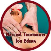 Natural Treatments for Edema