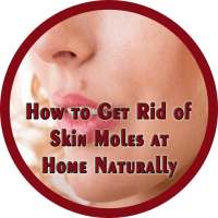 How to Get Rid of Skin Moles at Home Naturally