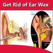 Get Rid of Ear Wax