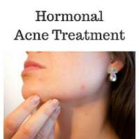 hormonal acne treatment