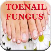 Toenail Fungus