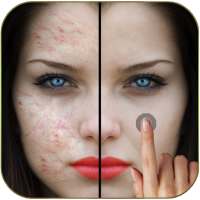 Pimples removing photo editing