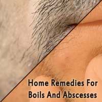 Home Remedies For Boils And Abscesses on 9Apps