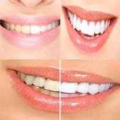 Whitening Teeth Tips