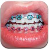 Real Braces Booth HD Studio on 9Apps