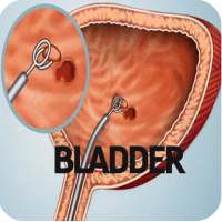 Bladder Cancer