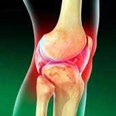 Cure joint pain! on 9Apps