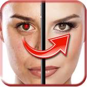 Red Eye Remover on 9Apps