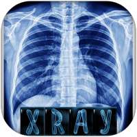 X Ray scanner interpretaion on 9Apps