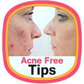 Acne Free Tips