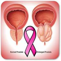 Prostate Cancer on 9Apps