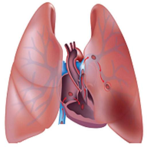 Pulmonary & Diseases