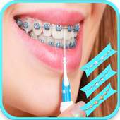braces bretelles teeth both pro on 9Apps