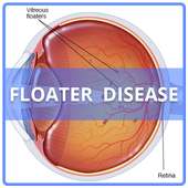 Floater Disease on 9Apps