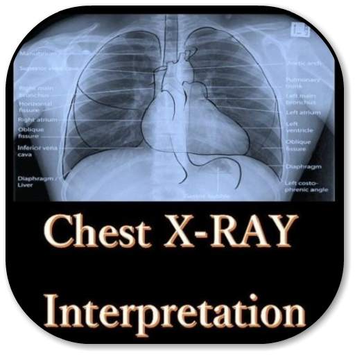 Chest X-Ray Interpretation - All in 1