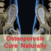 Osteoporosis cure