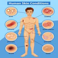 Atlas of All Skin Diseases & Treatments