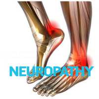 Neuropathy Disease