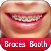 Braces Booth on 9Apps