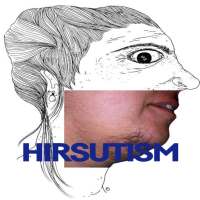 Hirsutism Disease on 9Apps