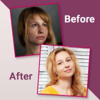 Before After Photo Collage - Compare Old Photos on 9Apps