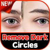 Dark Circles: Remove Dark Circles