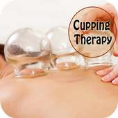 Cupping Therapy Hijama on 9Apps
