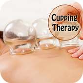 Cupping Therapy Hijama