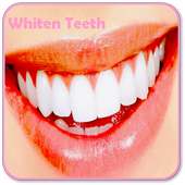 How to Whiten Teeth