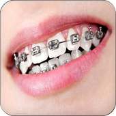 Real Braces Teeth Booth Pro