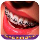 Real Braces Booth Photo Editor