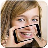 Braces Maker Pro on 9Apps