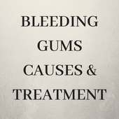 Bleeding Gums Causes