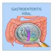 Important Aspects of Viral Gastroenteritis