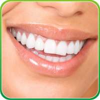 Whiter Teeth on 9Apps