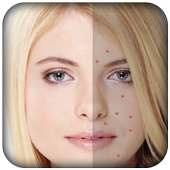 Pimple Remover-Pimple Eraser on 9Apps