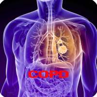 COPD Disease