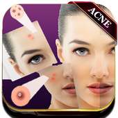Acne Remover Photo Editor - Pimple remover on 9Apps