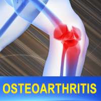 Osteoarthritis Joint Pain Treatment Home Remedies on 9Apps