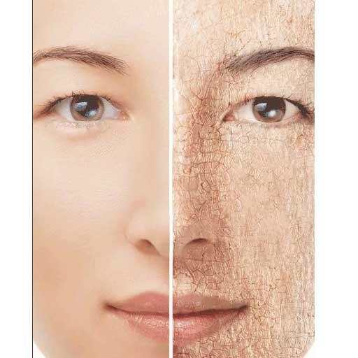 Dry Skin Causes and Solutions