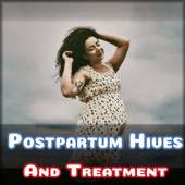 Dealing Postpartum Hives