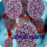 Genitalwarts Infection