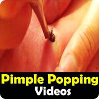 Best Pimple Popping Videos - Remove Blackheads on 9Apps