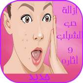 إزالة حب الشباب on 9Apps