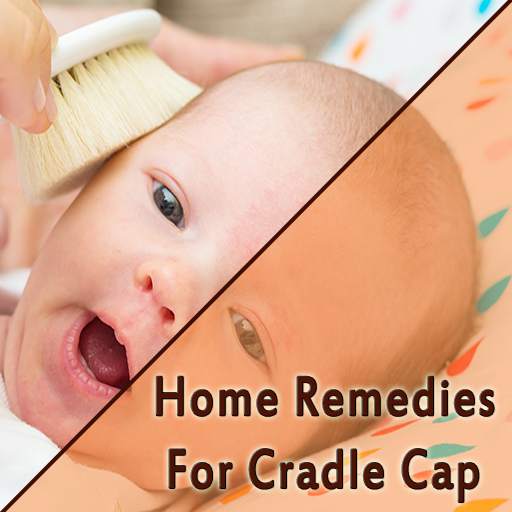 Home Remedies For Cradle Cap