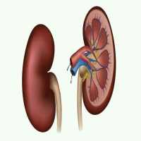 Home Remedies For Kidney Stones